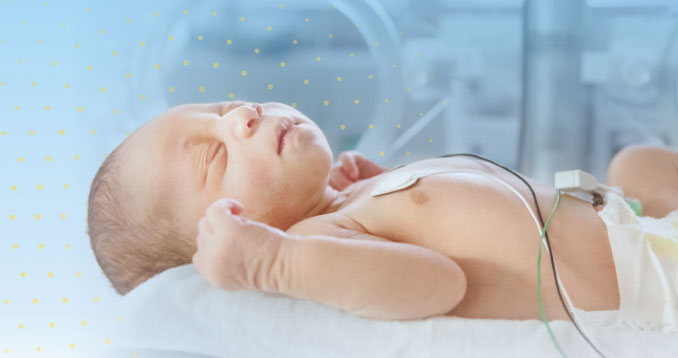 infant with seizures caused by MoCD Type A